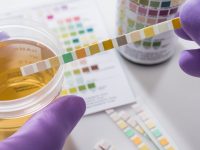 Urine weg infectie