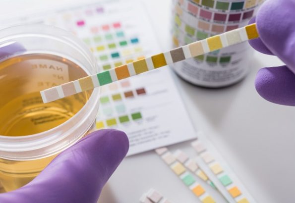 Urine weg infectie